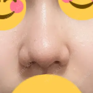 X CLINIC X CLINIC 大阪院口コミ