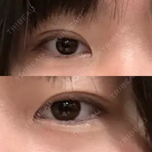 アリエル美容クリニック アリエル美容クリニック 大宮院口コミ