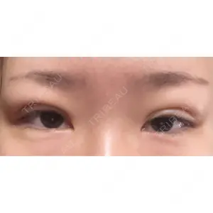 口コミ