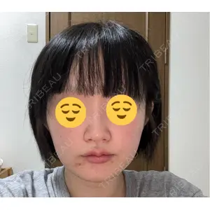 BiBiクリニック口コミ