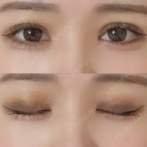 口コミ