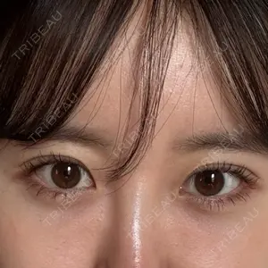 口コミ