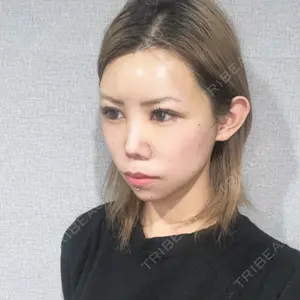 東京シンデレラ美容外科 東京シンデレラ美容外科 池袋院口コミ