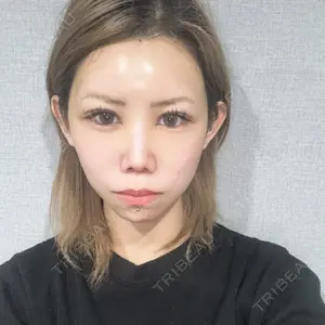 東京シンデレラ美容外科 東京シンデレラ美容外科 池袋院口コミ