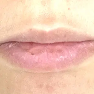 ルラ美容クリニック 渋谷本院の
