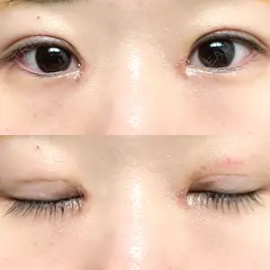 東京シンデレラ美容外科 東京シンデレラ美容外科 池袋院口コミ