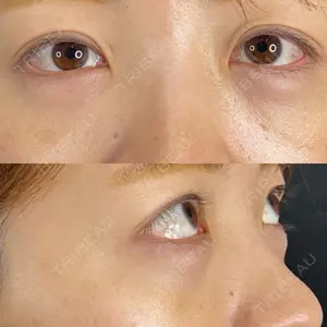 藤・ナチュレ美容クリニック 藤・ナチュレ美容クリニック 銀座院口コミ