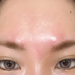 Re:anne clinic 銀座 【リアンクリニック銀座】口コミ