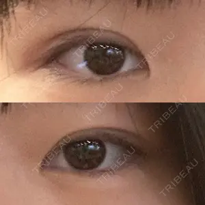 アリエル美容クリニック アリエル美容クリニック 大宮院口コミ