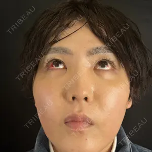 藤・ナチュレ美容クリニック 藤・ナチュレ美容クリニック 銀座院口コミ