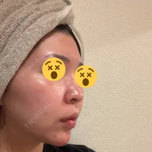 口コミ