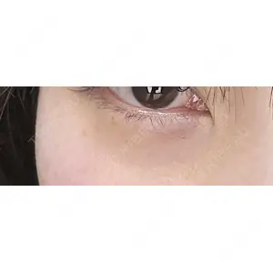 しのぶ皮膚科口コミ