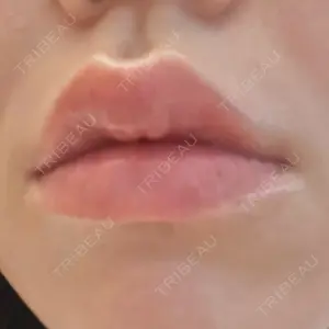 ルラ美容クリニック ルラ美容クリニック 名古屋本院口コミ