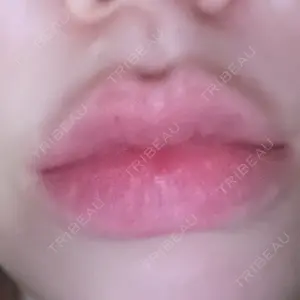 ルラ美容クリニック ルラ美容クリニック 名古屋本院口コミ