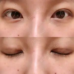 湘南美容クリニック 湘南美容クリニック 柏院口コミ