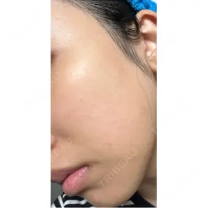 CZEN CLINIC 銀座院口コミ