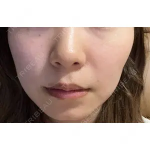 東京美容外科 名古屋院口コミ