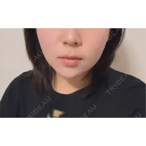 口コミ