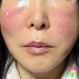 口コミ