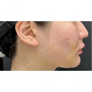 BLINC CLINIC （ブリンク クリニック）口コミ
