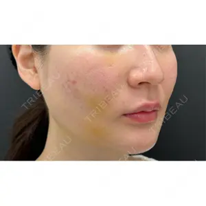 BLINC CLINIC （ブリンク クリニック）口コミ