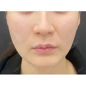 BLINC CLINIC （ブリンク クリニック）口コミ