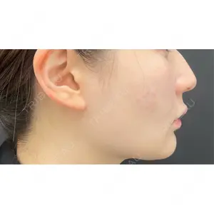 BLINC CLINIC （ブリンク クリニック）口コミ