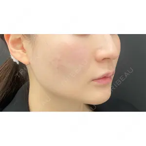 BLINC CLINIC （ブリンク クリニック）口コミ