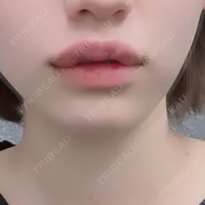 アネシス美容クリニック口コミ