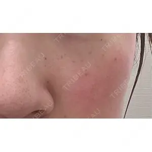 ルラ美容クリニック ルラ美容クリニック 名古屋栄院 / ルラスキンクリニック 名古屋栄院口コミ