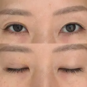 湘南美容クリニック 湘南美容クリニック 枚方院口コミ