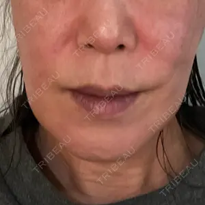 口コミ