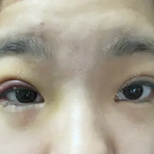 湘南美容クリニック 湘南美容クリニック 千葉センシティ院口コミ