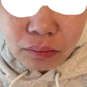 口コミ