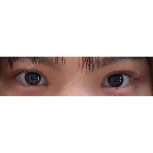 東京シンデレラ美容外科 東京シンデレラ美容外科 池袋院口コミ
