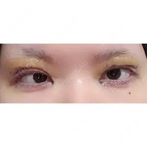 LUHO（ルホ）美容外科口コミ