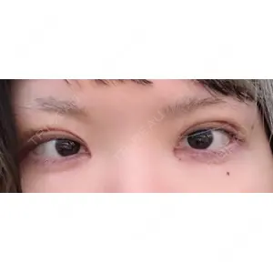 LUHO（ルホ）美容外科口コミ