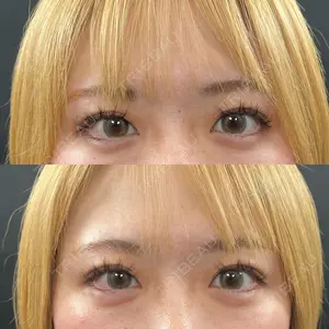 口コミ