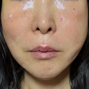 口コミ