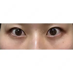 藤・ナチュレ美容クリニック 藤・ナチュレ美容クリニック 銀座院口コミ