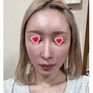 銀座マイアミ美容外科口コミ