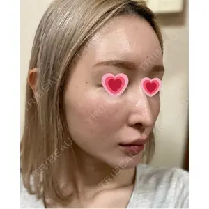 銀座マイアミ美容外科口コミ