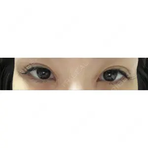 HAAB×DREAM BEAUTY CLINIC HAAB×DREAM BEAUTY CLINIC 東京本院口コミ