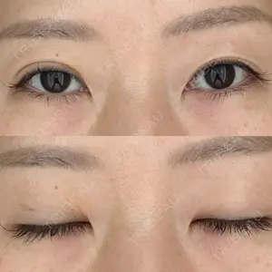 湘南美容クリニック 湘南美容クリニック 枚方院口コミ