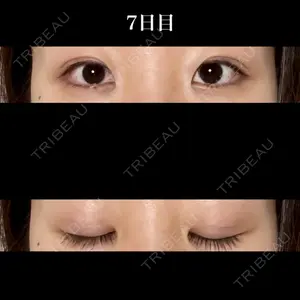 東京シンデレラ美容外科 東京シンデレラ美容外科 新宿院口コミ