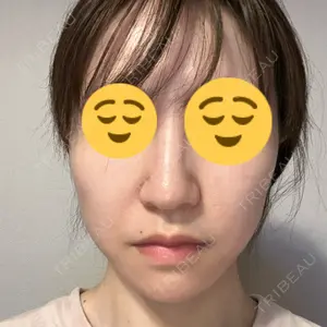 HINATA クリニック口コミ