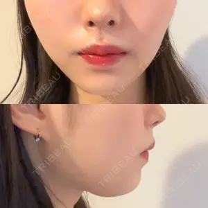 DMTC美容皮膚科 DMTC美容皮膚科 日本橋院口コミ