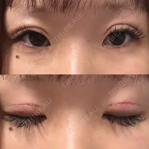 口コミ