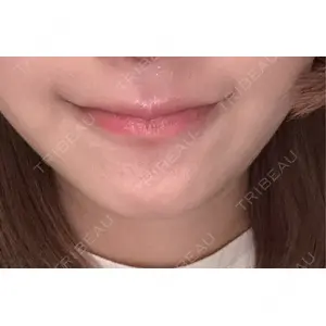 口コミ