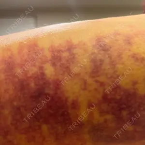 ヴェルトラクリニック ヴェルトラクリニック 大阪院口コミ